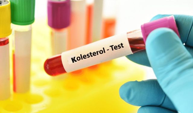 Kolestrol Testi Nasıl Yapılır?