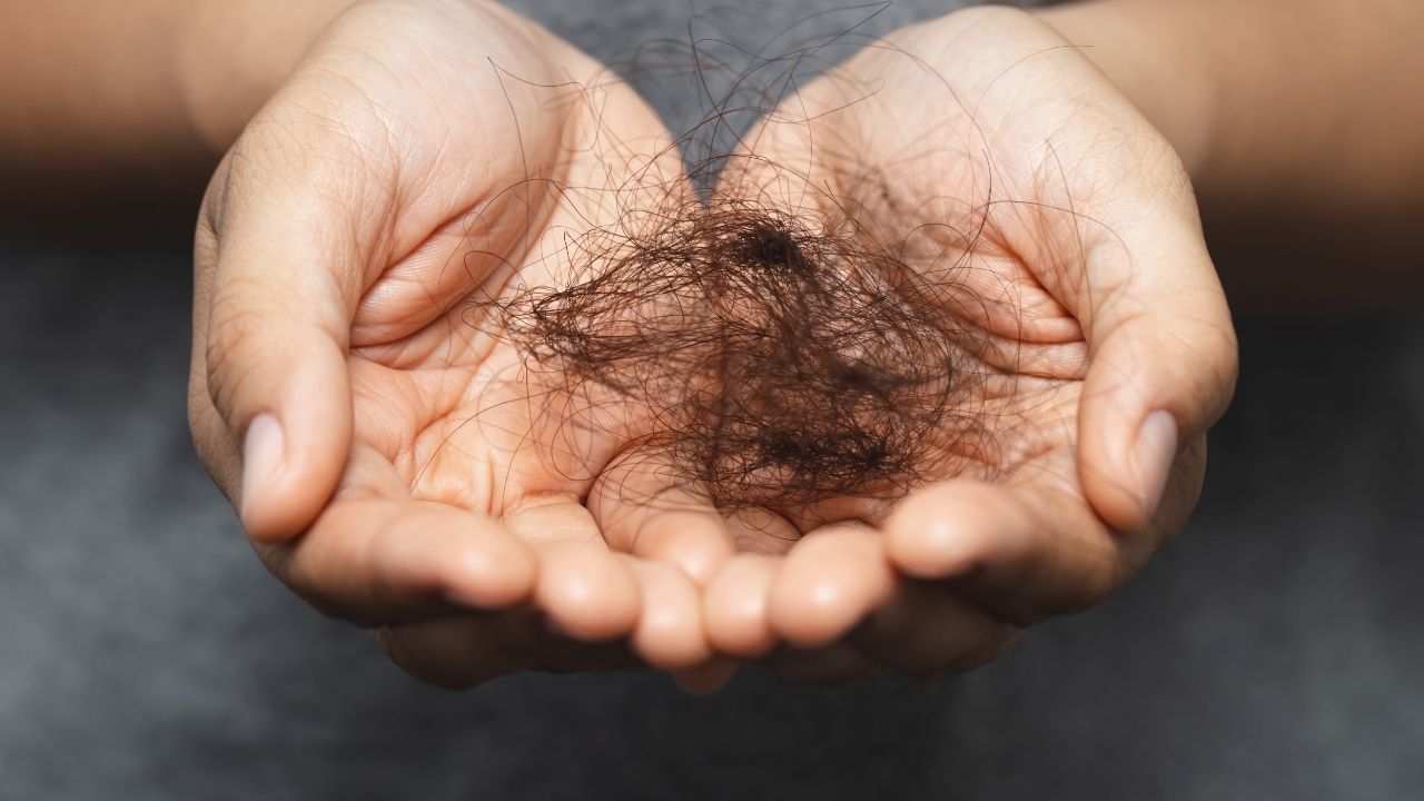 Saç Dökülmesi (4)