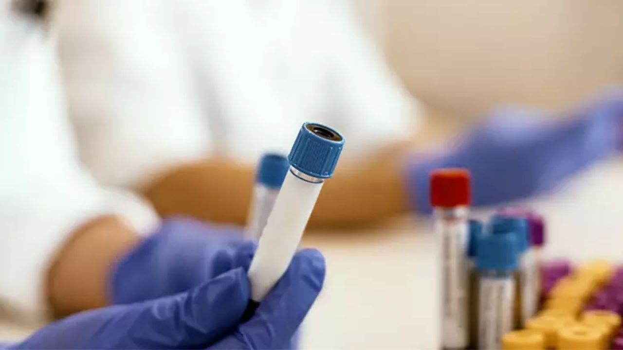 Kan Testleri Ve Sağlık Kimler Hangi Testleri Düzenli Yaptırmalı